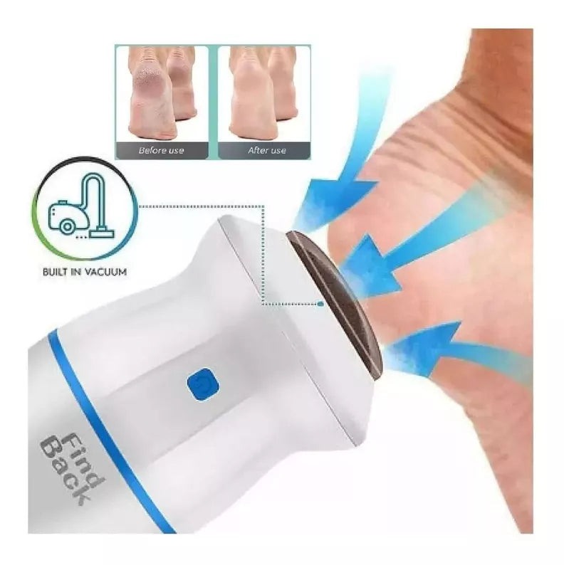 Callobliss™ 😣 ¿Talones agrietados, callos duros y piel seca? +ENVIO GRATIS