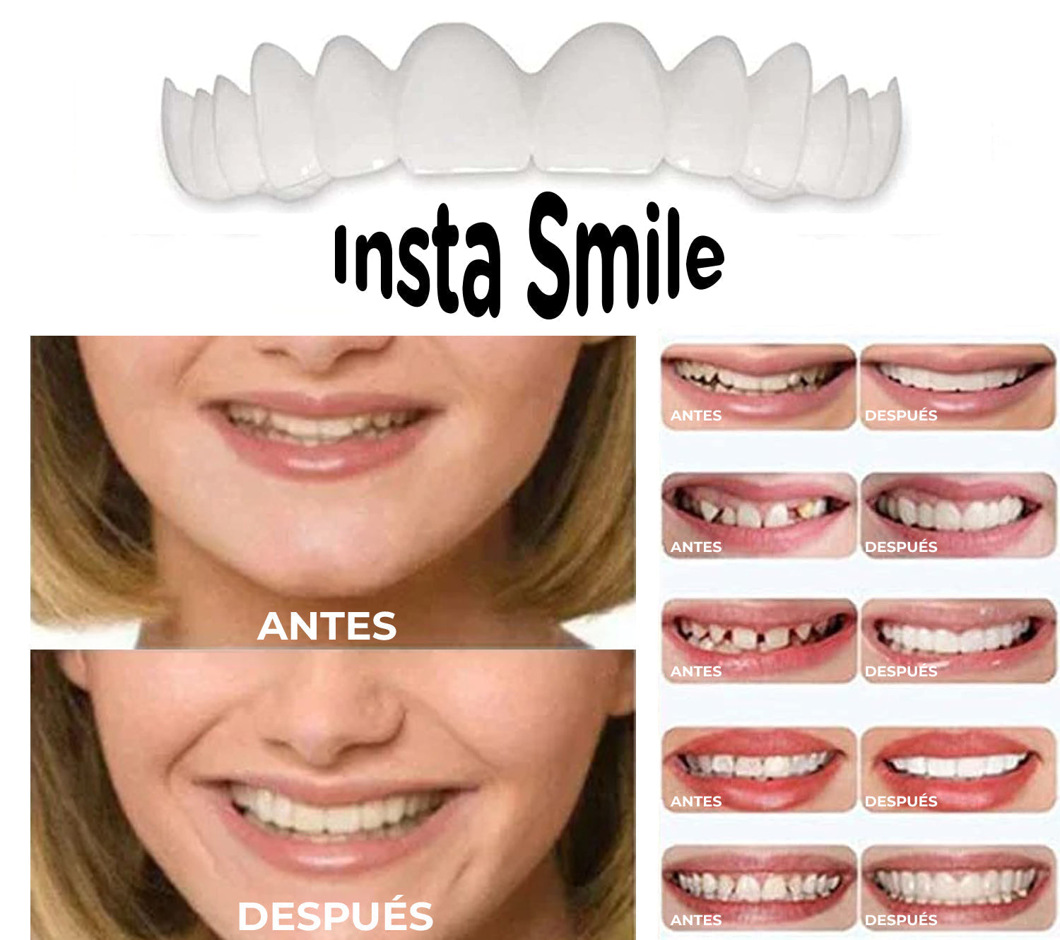 InstaSmile™ – Dientes perfectos al instante 😁 + Envío GRATIS en Guatemala