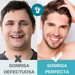 SonríeYa™ Dientes Postizos Temporales