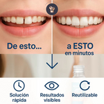 SonríeYa™ Dientes Postizos Temporales