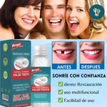 SonríeYa™ Dientes Postizos Temporales
