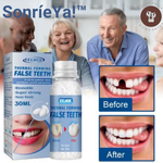 SonríeYa™ Dientes Postizos Temporales